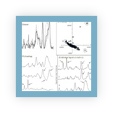 Thumbnail of graphs summarising the benefit of using multivariate components for signal processing taken from paper this link directs to