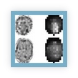 Raman maps of prostatic cell lines for normal and cancerous cells. Shown are the cytoplasm and nucleus distributions