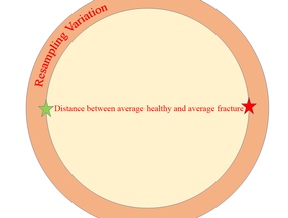 Schematic showing the variability in repeated measurement of a nail compared with the average difference between healthy and fracture. The inherited methodology had resampling error 1.2 x the size of the group separation.