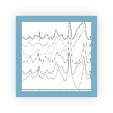 Plot showing that the application of different intensity normalisation routines to spectral and signal based data can radically alter the distribution in a dataset.