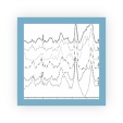 Plot showing that the application of different intensity normalisation routines to spectral and signal based data can radically alter the distribution in a dataset.