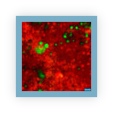 Thumbnail from linked paper of a Raman image comparing the distribution of chemical constitutents within a filter membrane (Bruch's) at the rear of the eye