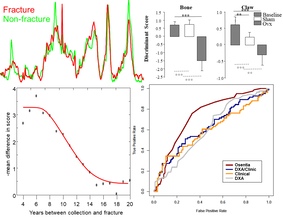 Results of the clinical trails, showing the differences in signals between healthy and fracture samples, the similarity between bone and nail tissue, , the change in contrast with time gap between nail collection and fracture and the performance of the test against its competitors