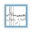 Raman spectra showing the chemical changes induced when proteins are modified by glycation or lipoxidation