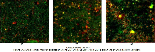 Image showing how different stressors accumulate with age in the retinal filter